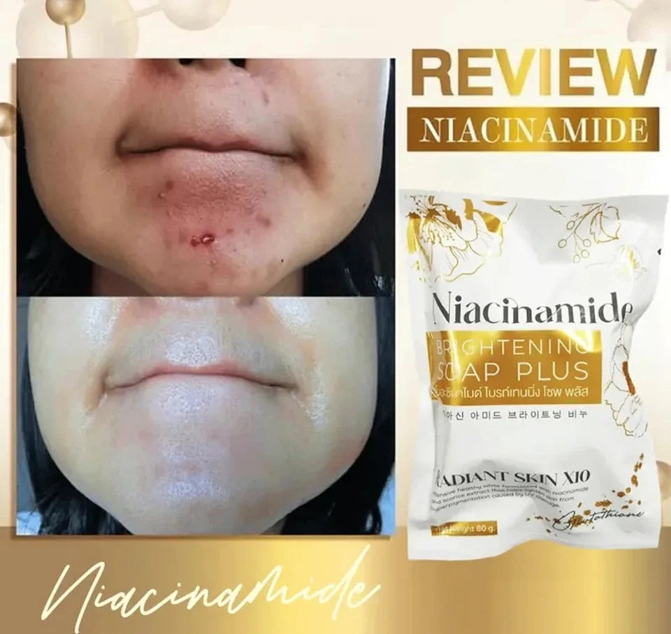 Authentic From Thailand! Glow Skin Niacinamide Brightening Soap