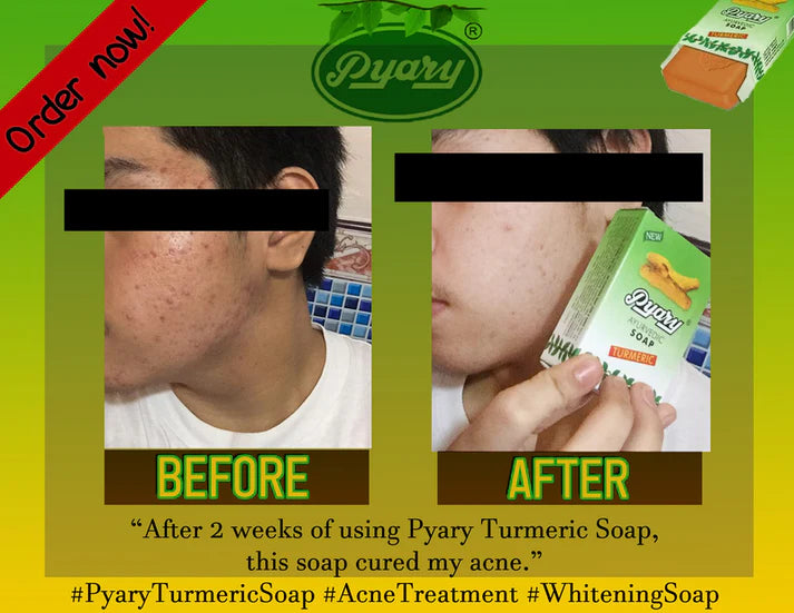Pyary Ayurvedic Turmeric Soap (75G)